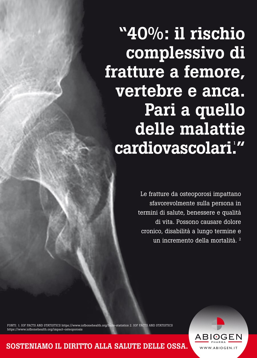 Soggetto lastra-min